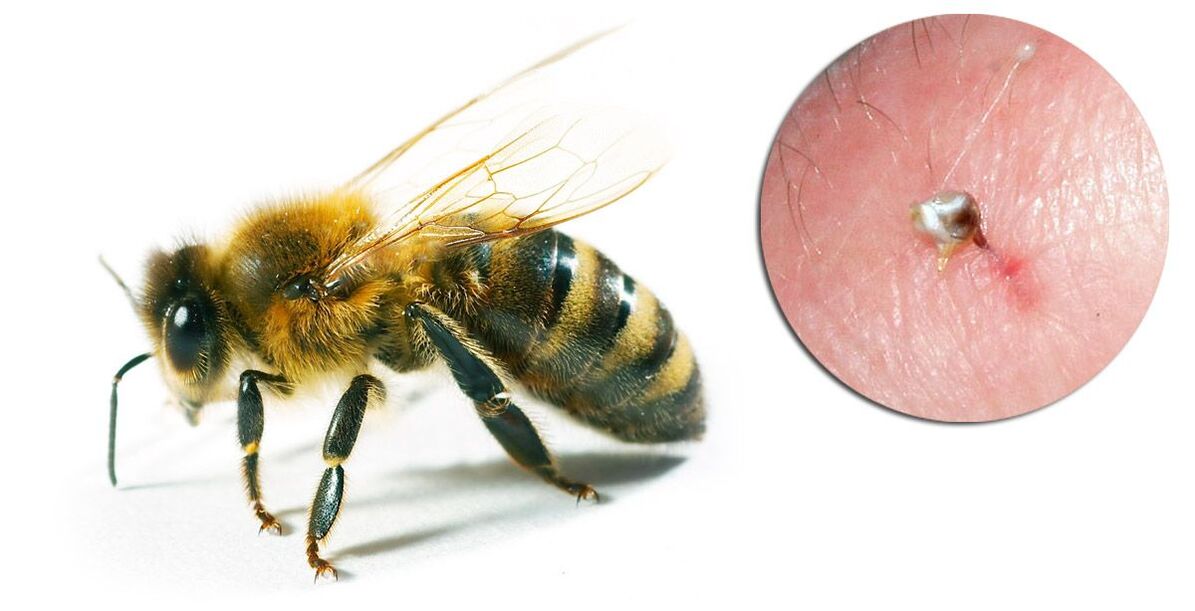Hondrostrong садржи пчелињи отров који побољшава метаболичке процесе у ткивима